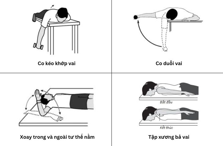 chăm sóc bệnh nhân viêm quanh khớp vai