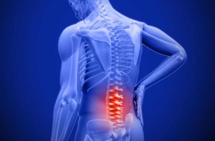 nguyên nhân đau cổ vai gáy