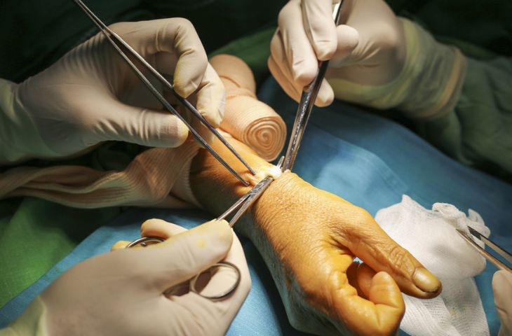 bệnh viêm bao gân có nguy hiểm không