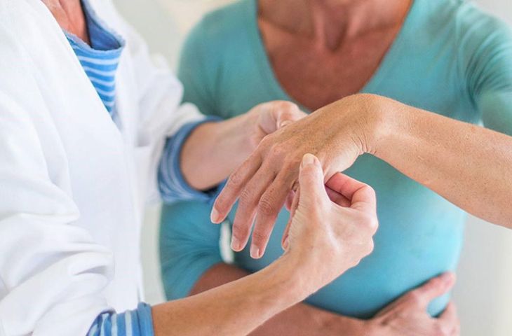 Bị viêm khớp dạng thấp cần điều trị bệnh sớm để tránh biến chứng nguy hiểm