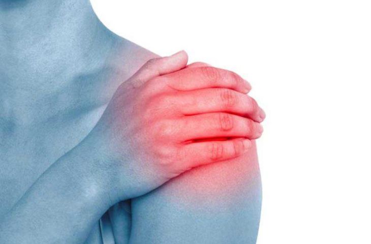 viêm quanh khớp vai