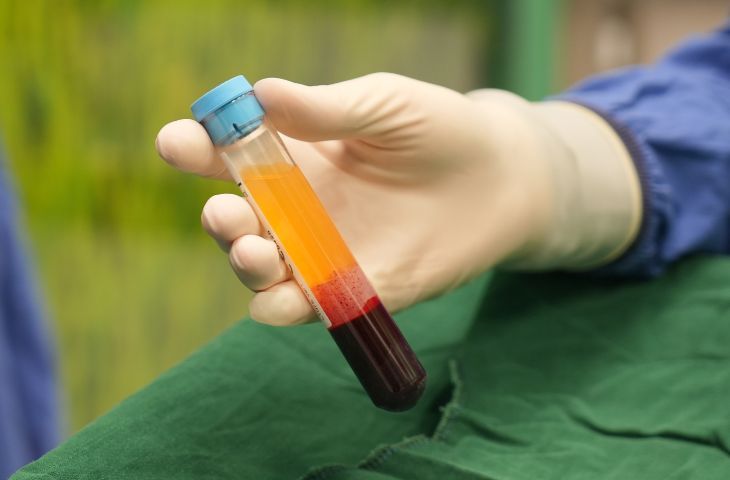 Phương pháp điều trị thoái hóa khớp bằng PRP