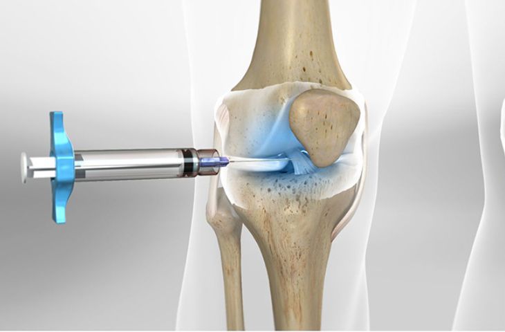 Tiêm PRP có tác dụng gì?