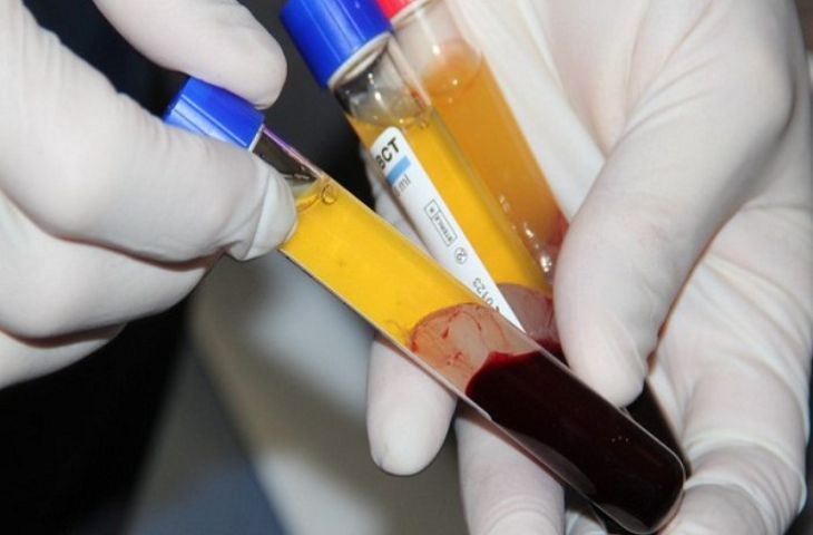 Tiêm PRP có tác dụng gì?