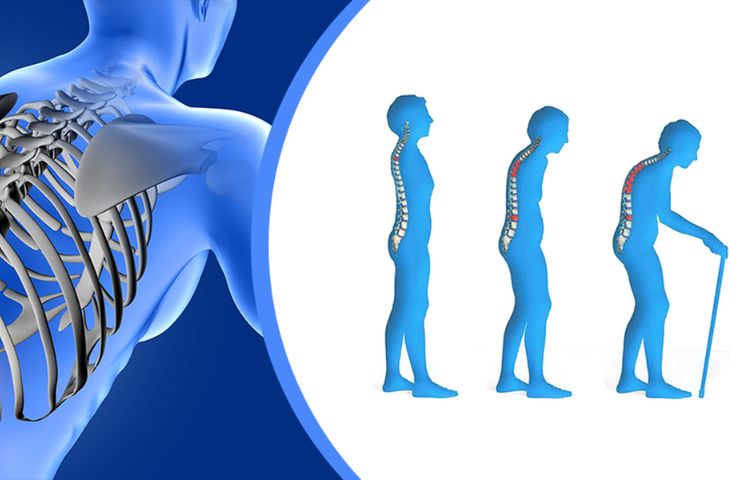 triệu chứng đau lưng