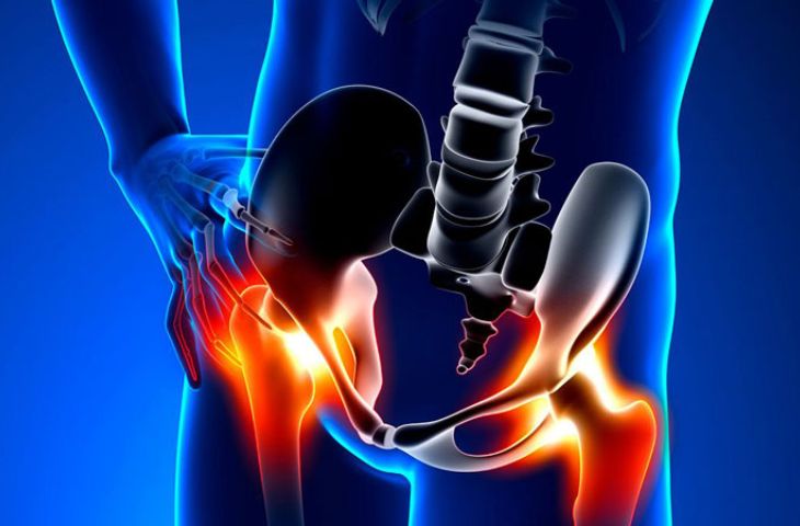 triệu chứng thoái hóa khớp háng