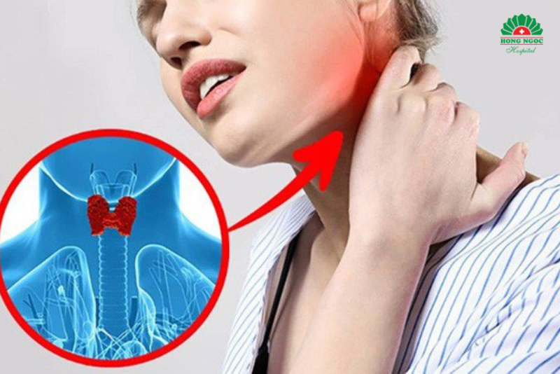 Bệnh u tuyến giáp gây nên nhiều ảnh hưởng đến sức khỏe người bệnh
