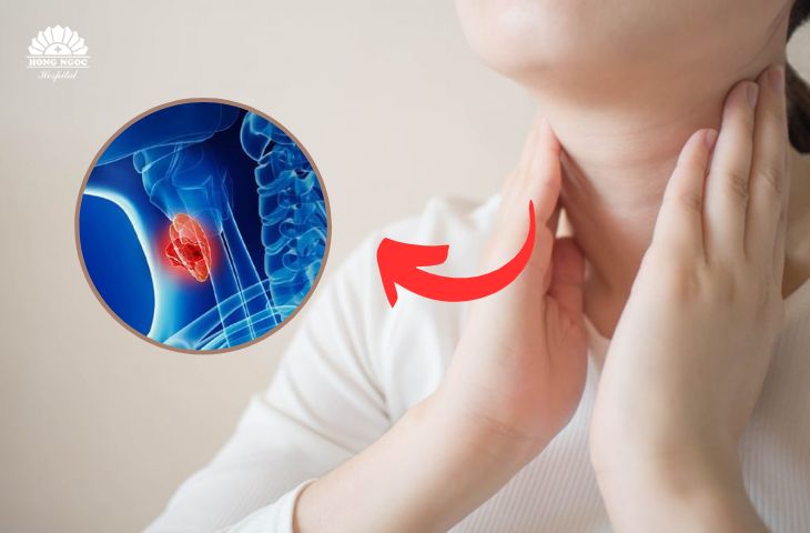 Nhận biết riệu chứng để điều trị ung thư tuyến giáp