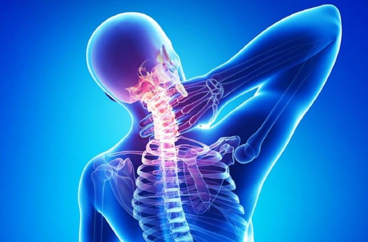 thoái hóa cột sống cổ