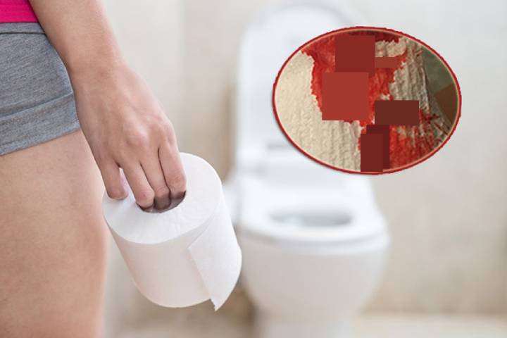 Rectal bleeding during defecation is a sign that may help postpartum women recognize postpartum hemorrhoids.