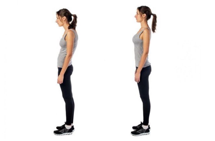 xẹp đốt sống lưng có nguy hiểm không