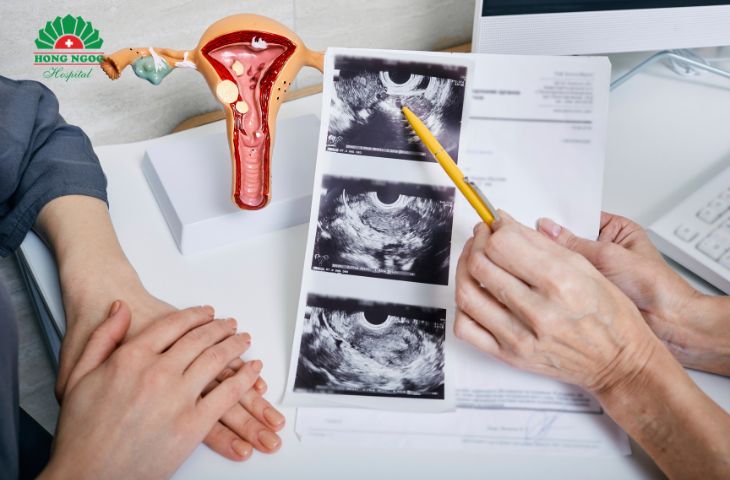 Kinh nguyệt không đều là biểu hiện của nhiều bệnh lý phụ khoa nguy hiểm