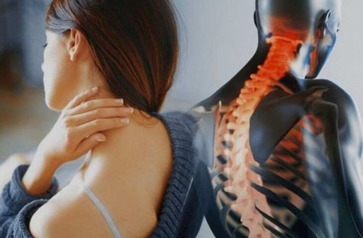 thoái hóa đốt sống cổ có nguy hiểm không