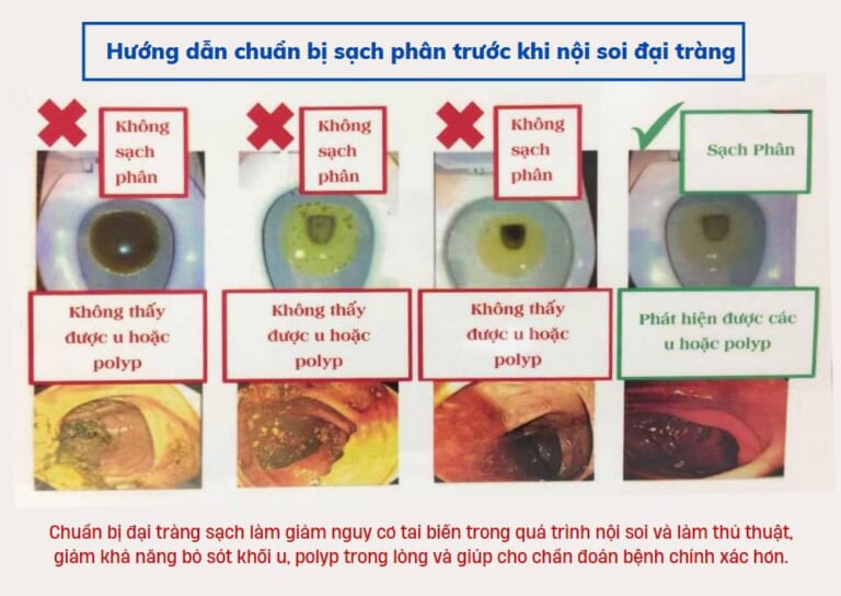 lam-sach-dai-trang-tai-nha-3