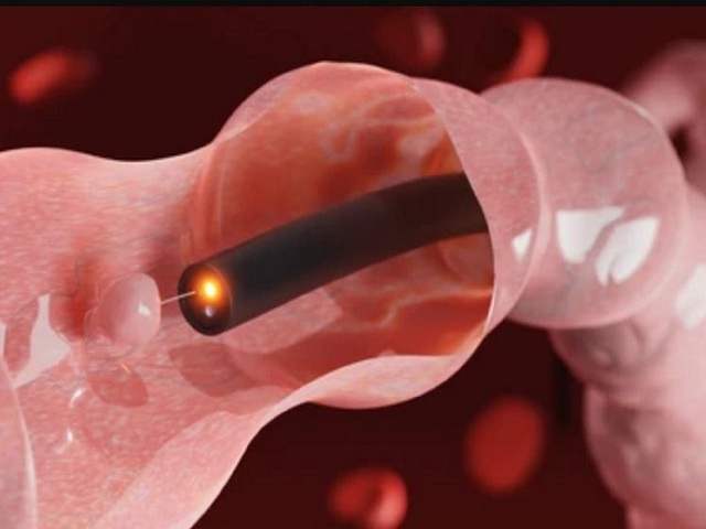 lam-sach-dai-trang-tai-nha