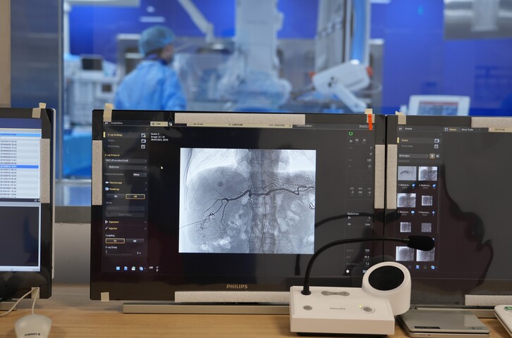 nut-mach-dieu-tri-ung-thu-gan-2