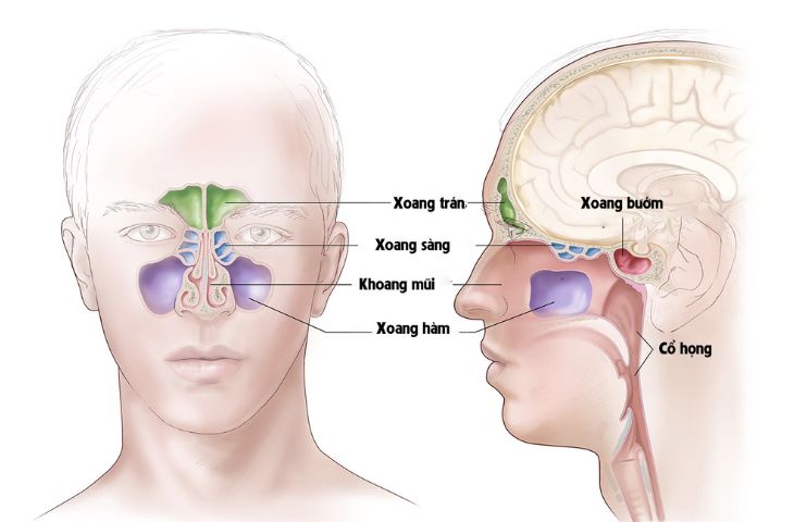 Viêm đa xoang là gì?
