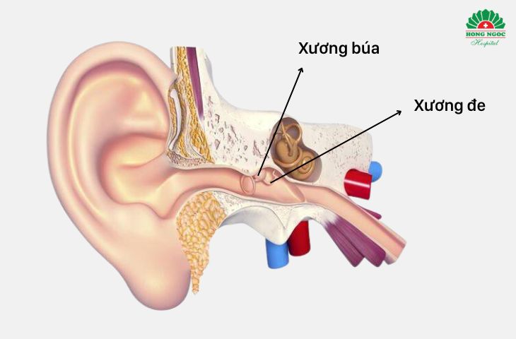 Phẫu thuật chỉnh hình tai giữa giúp tái tạo chuỗi xương con