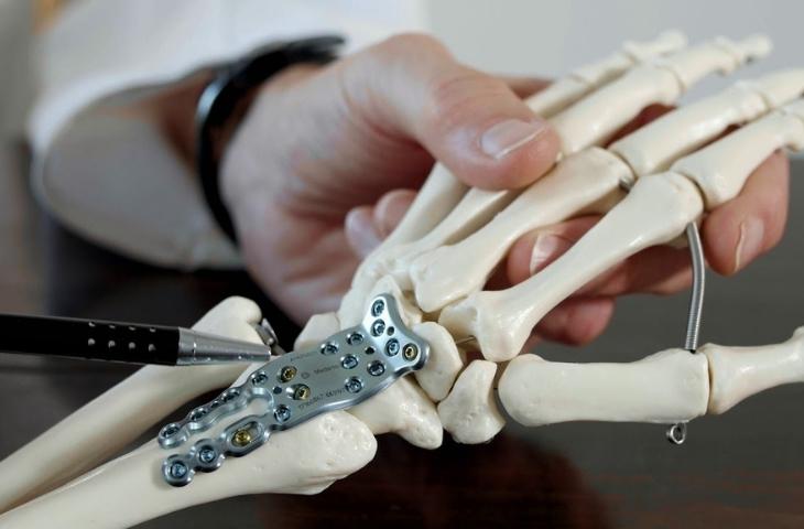 phẫu thuật kết hợp xương sinh học