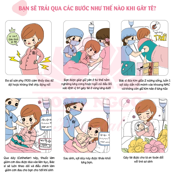 Gây tê ngoài màng cứng