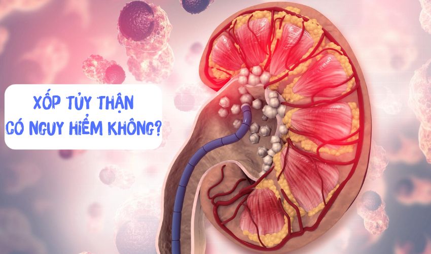 xop tuy than co nguy hiem khong