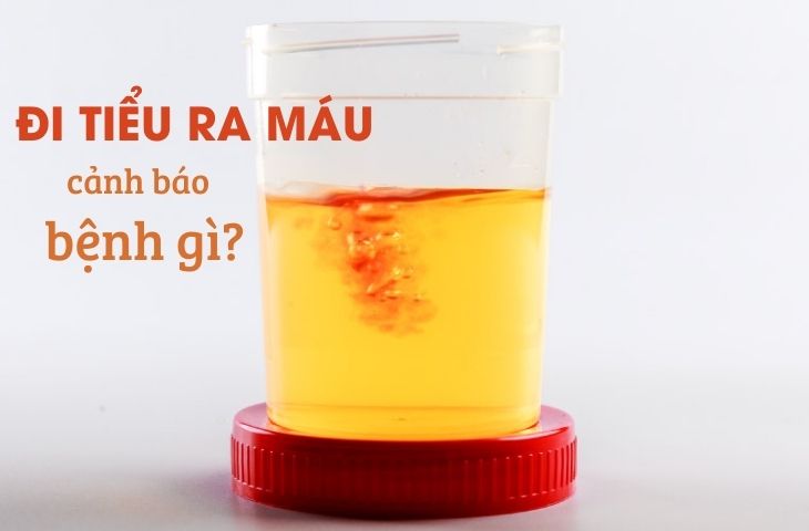di tieu ra mau