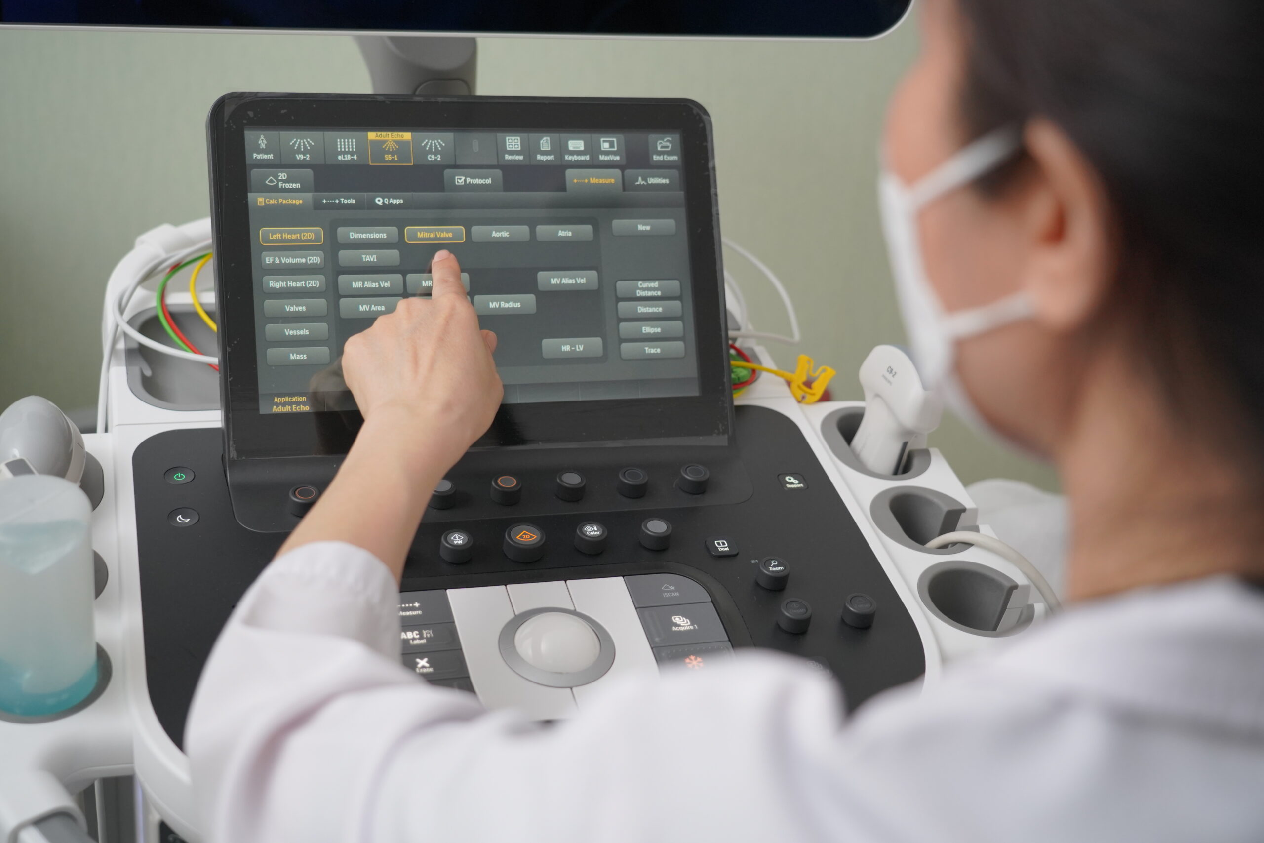 Nhịp tim chậm được phát hiện trên hình ảnh siêu âm