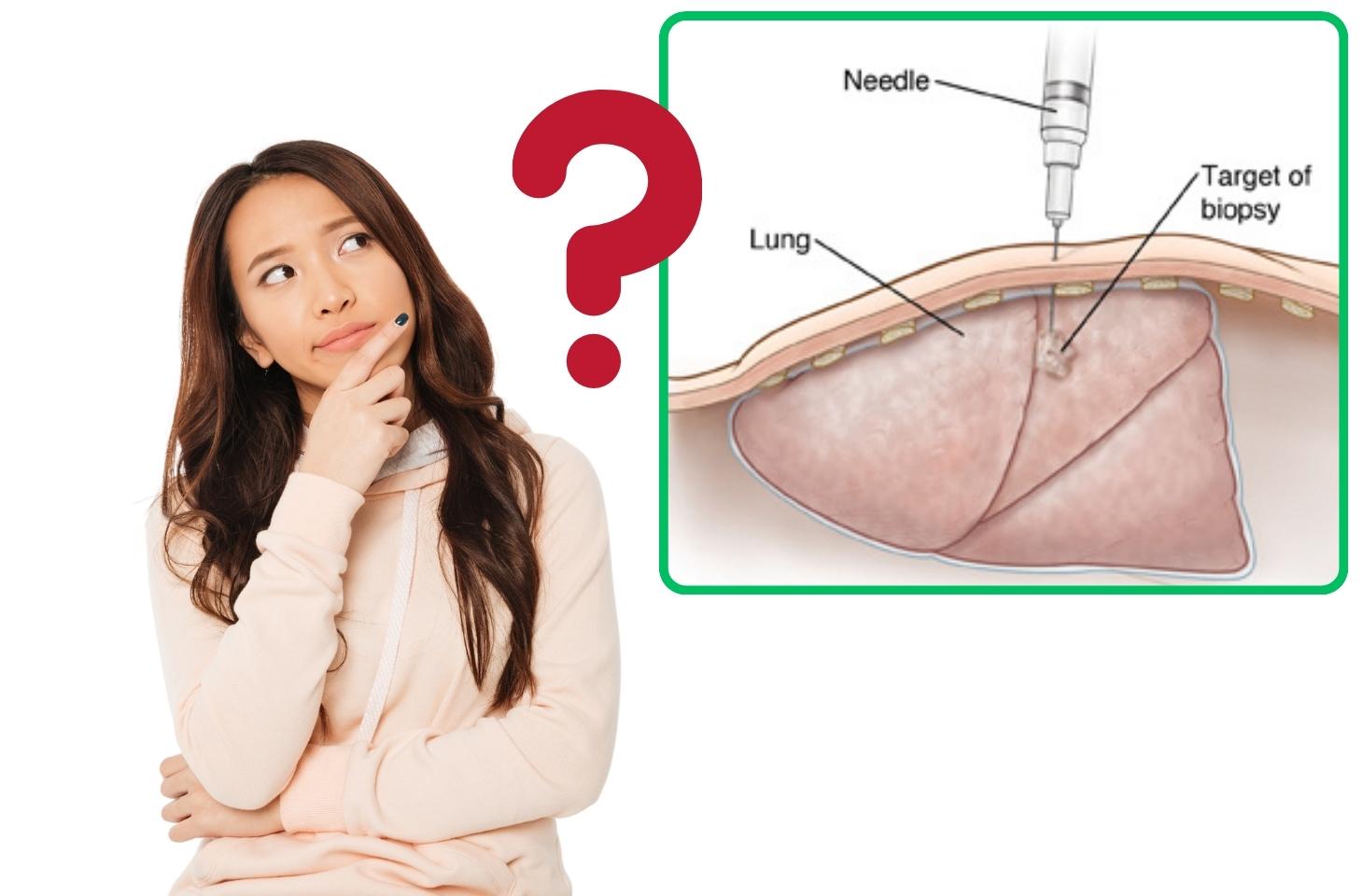 sinh thiết u phổi có đau không