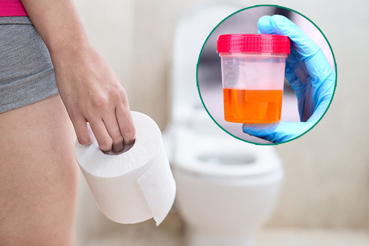 tieu ra mau co tu khoi khong