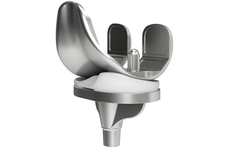 các loại khớp gối nhân tạo