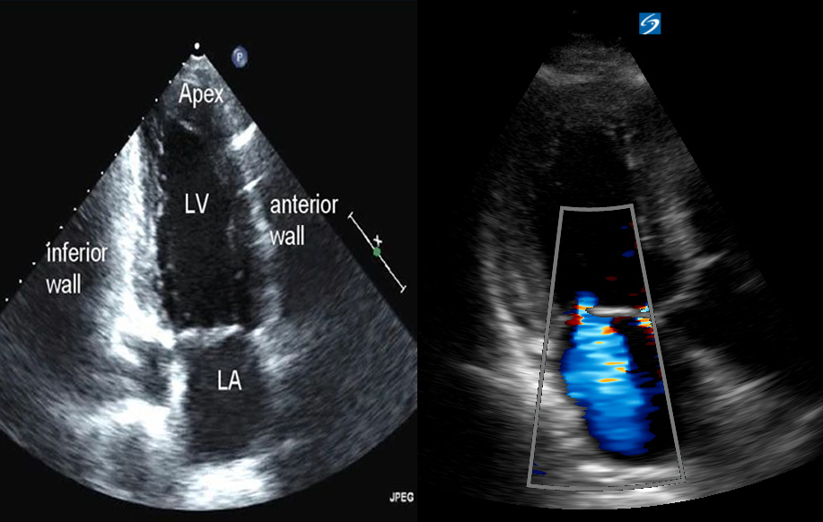 Mặt cắt trong siêu âm tim cơ bản