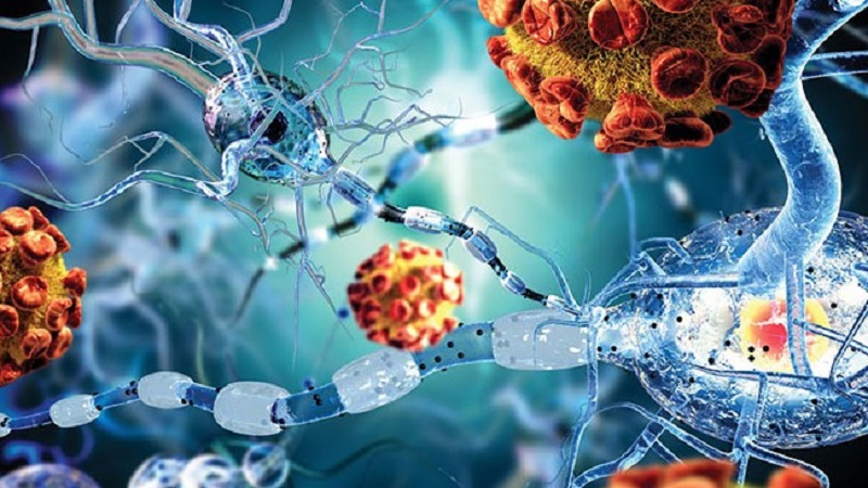 Suy giảm hệ miễn dịch tạo điều kiện cho vi khuẩn xâm nhập gây ra áp xe phổi