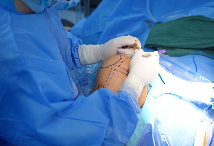 BVĐK Hồng Ngọc phẫu thuật thay khớp gối 