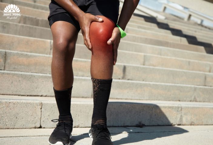 Chi phí phẫu thuật dây chằng khớp gối