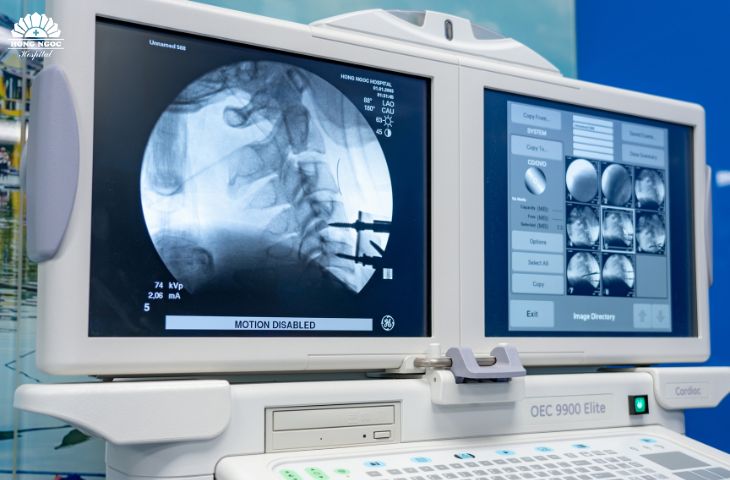 Phẫu thuật điều trị gãy cột sống